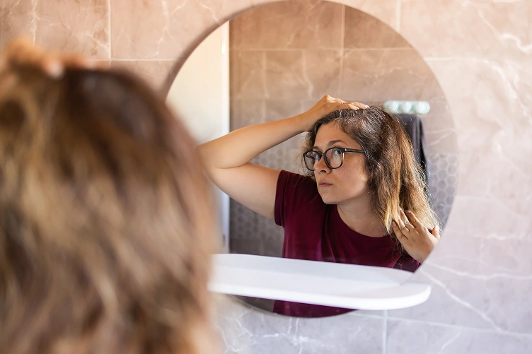 Perimenopause Hair Loss