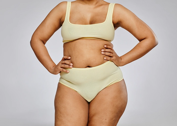 woman in underwear incontinence
